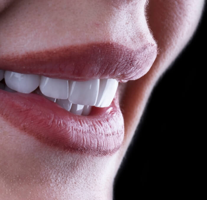 Closeup of flawless smile with veneers placed by cosmetic dentist