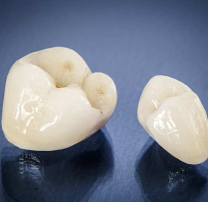 All-ceramic dental crowns