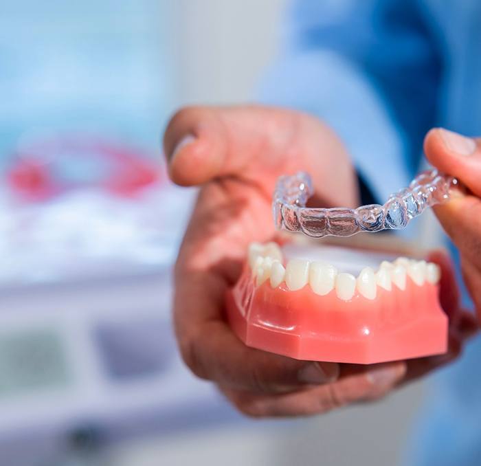 Dentist placing Invisalign aligner on model of teeth