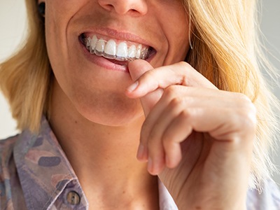 Woman removing Invisalign from top teeth