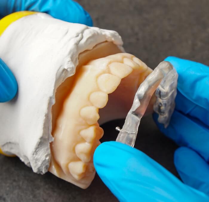 Dental lab technician crafting a custom occlusal splint