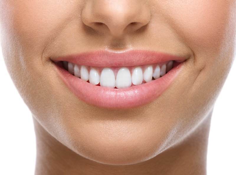 A closeup of a smile with white teeth
