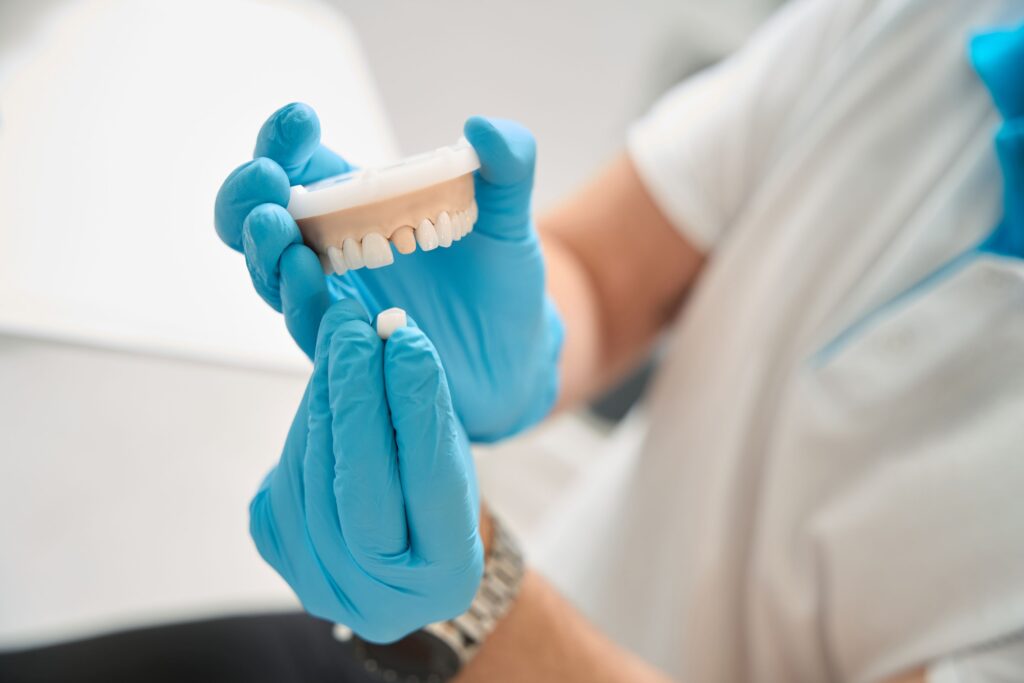 Gloved hands placing sample dental crown over model abutment tooth